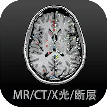 Ӱ�����ͼ��(ҽѧӰ��ѧϰƽ̨)v4.6.4 ��Ѱ�